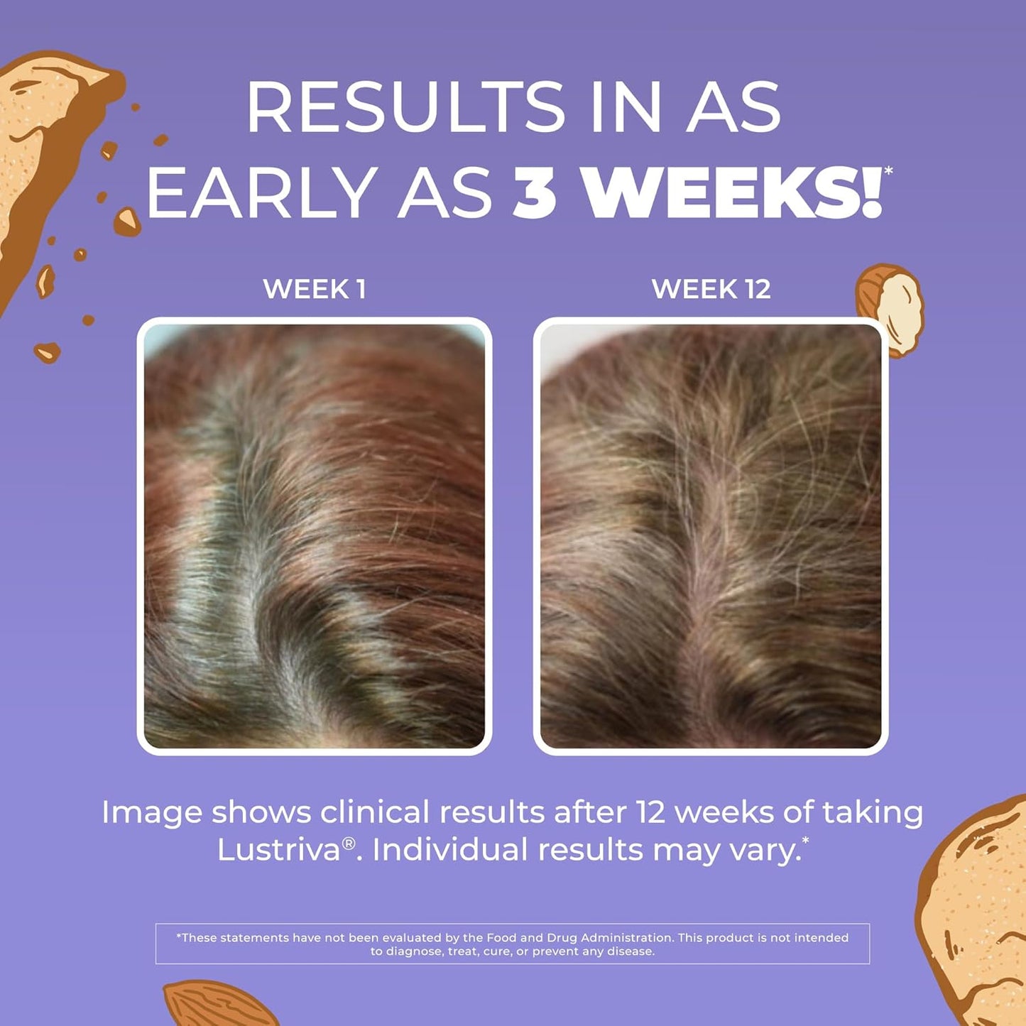 THICKER HAIR & SMOOTHER SKIN FROM WITHIN : Hair Growth Max Liposomal