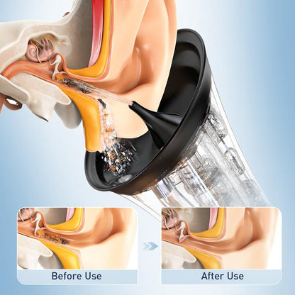 Electric Ear Wax Removal System - Water Irrigation Cleaning For Safer At-Home Ear Care